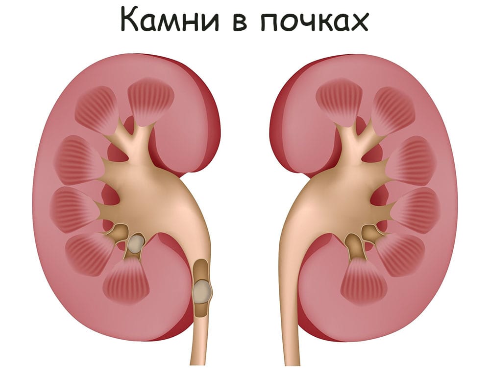 Кракен ссылка на тор официальная